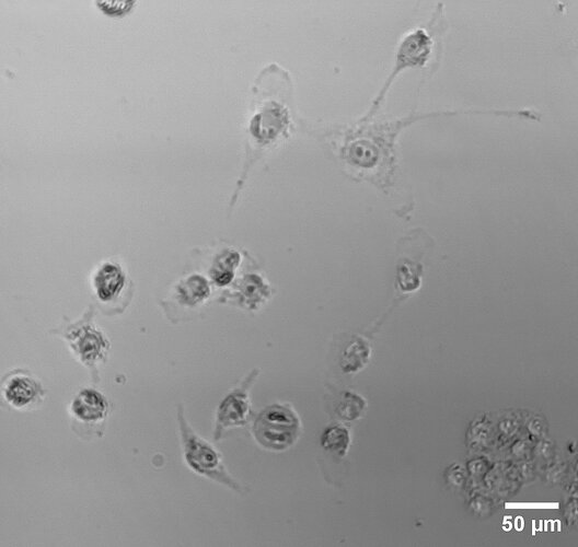 H1299_ lika cancer cells mitosis good focus mikas proper scasle bar cropped mitosis