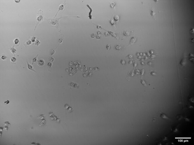 H1299_ lika cancer cells mitosis good focus mikas proper scale bar