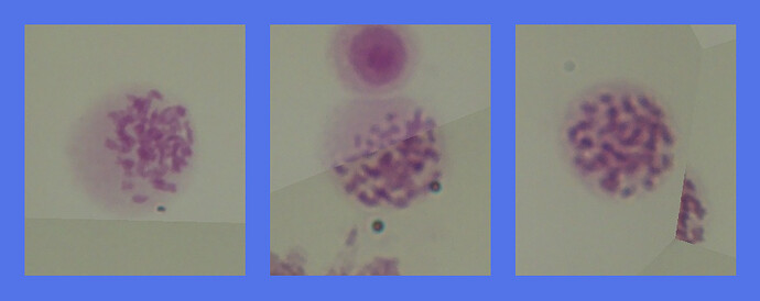 chromosome_smear_7500_steps_v1_0002_crops