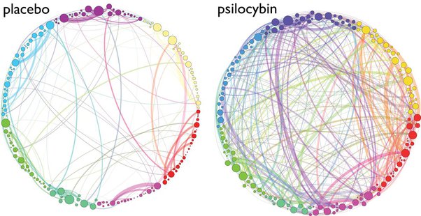 Brain Interconnections