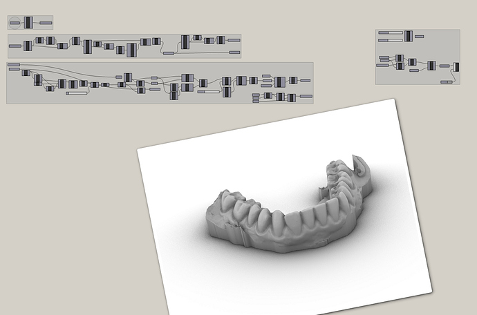 teeth_solid