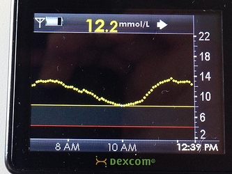 CGM screen with six hours of high readings of 8-14 mmol/L